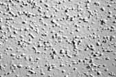 A close-up of a popcorn ceiling.