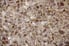 Looking closely at the mottled surface of terrazzo style flooring.
