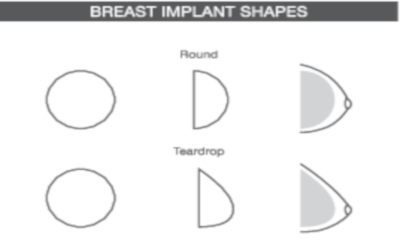 Breast Implant Shapes