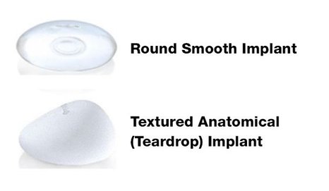 implant shape and texture