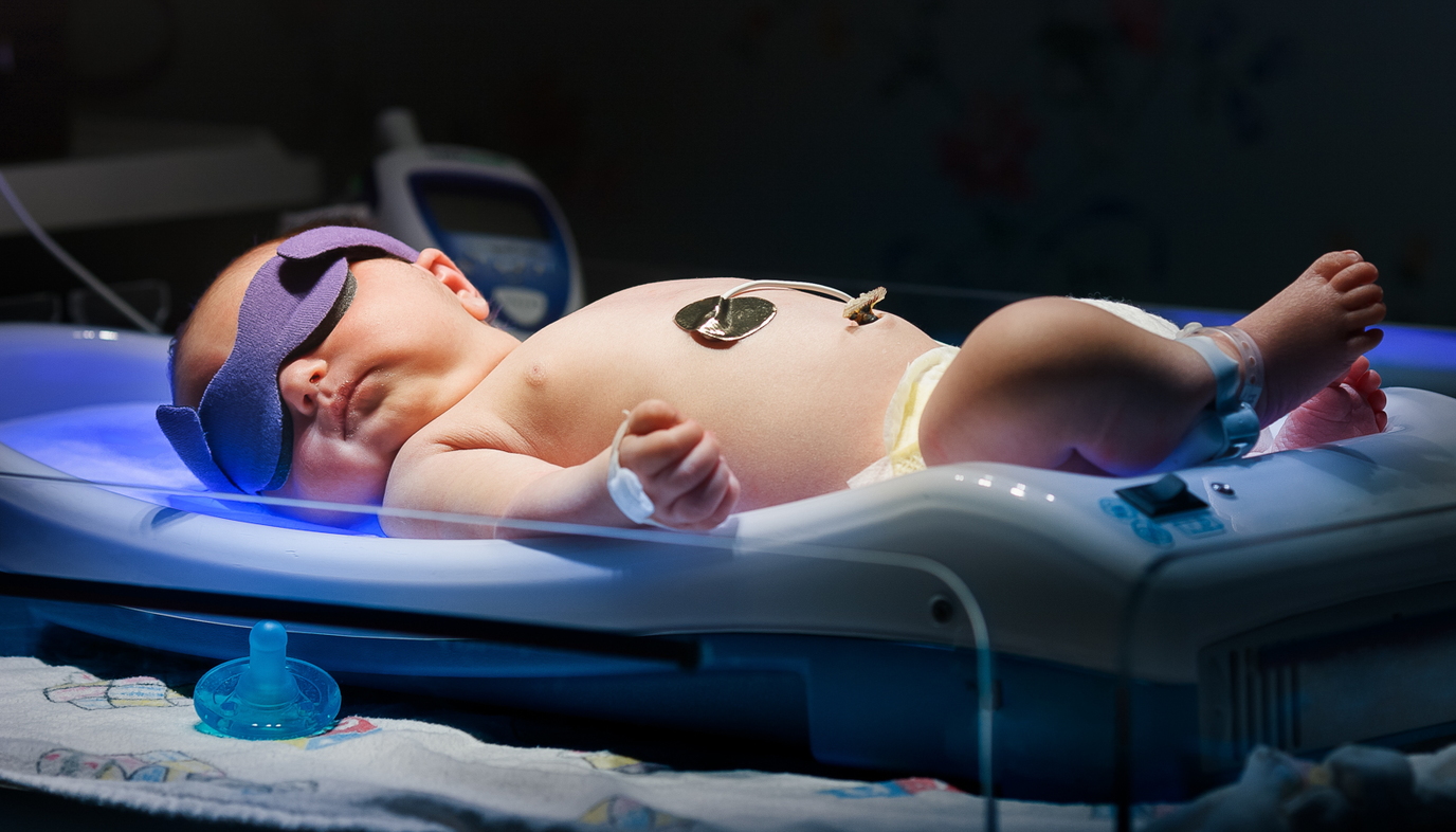 newborn with jaundice in the hospital