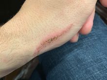 I took a wire wheel to the hand.