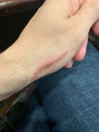 I took a wire wheel to the hand.