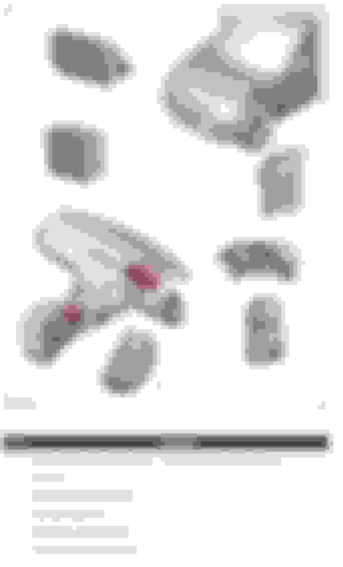 Radar sensor blocked Land Rover Forums Land Rover Enthusiast Forum