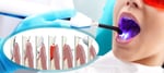 Laser Dentistry in Chandigarh