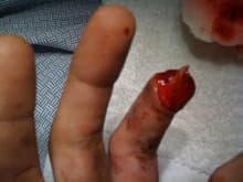 finger 3