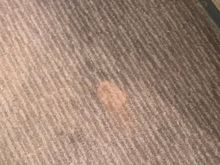 Stains  on carpet near wardrobe 