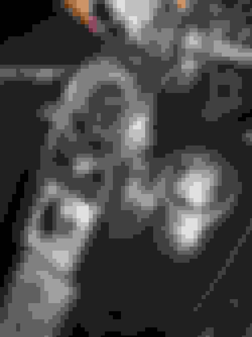 1994 Fatboy Speedometer Removal Harley Davidson Forums