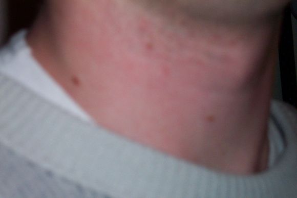 100_3827.JPG