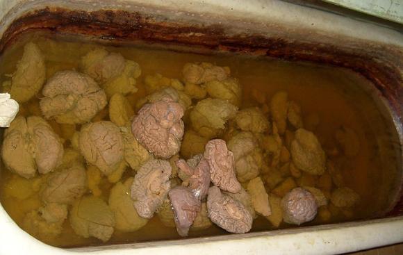 Tub O brains
