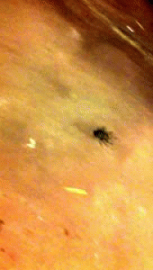 spiders